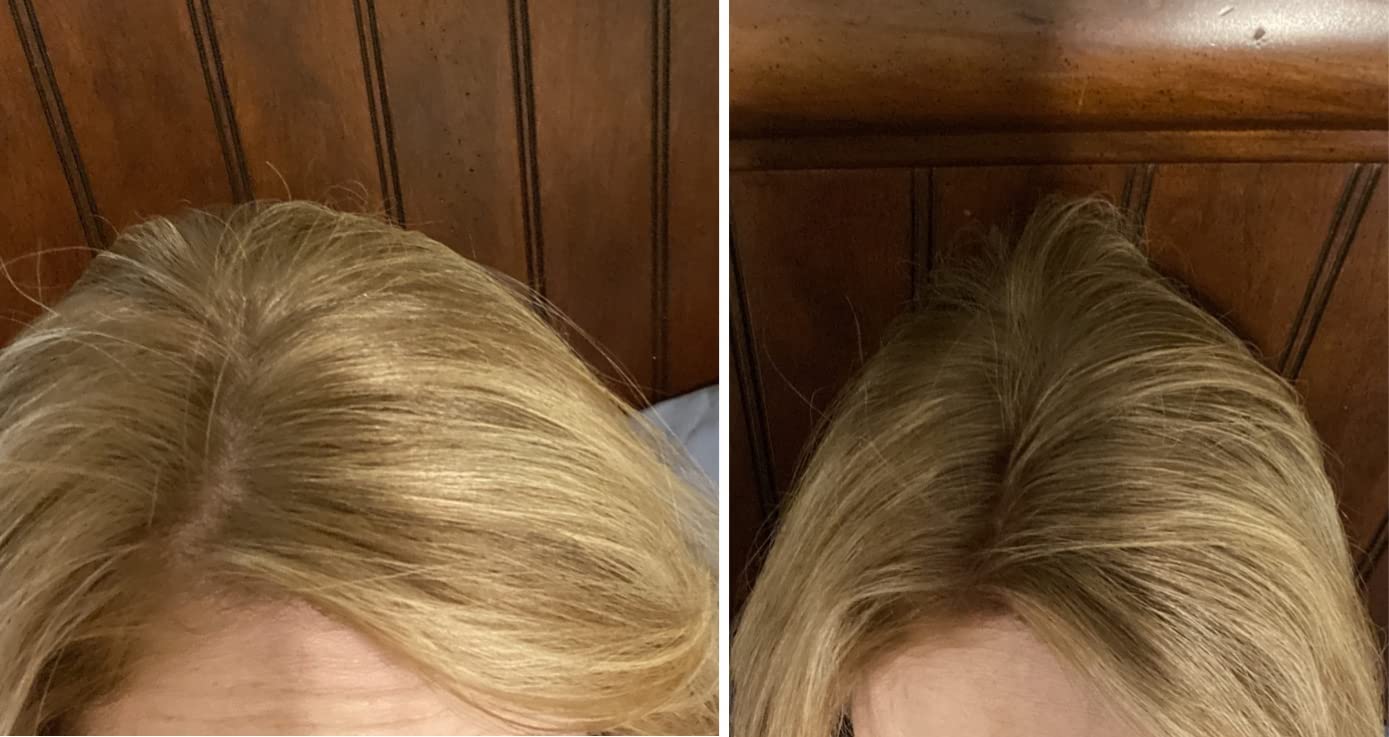 Caboki Hair Loss Concealer. All-Natural Hair Building Fiber. Make Thin Hair Look 10X Fuller Instantly. Eliminate the Appearance of Bald Spot and Thinning Hair (30G, 90-Day Supply). BLONDE