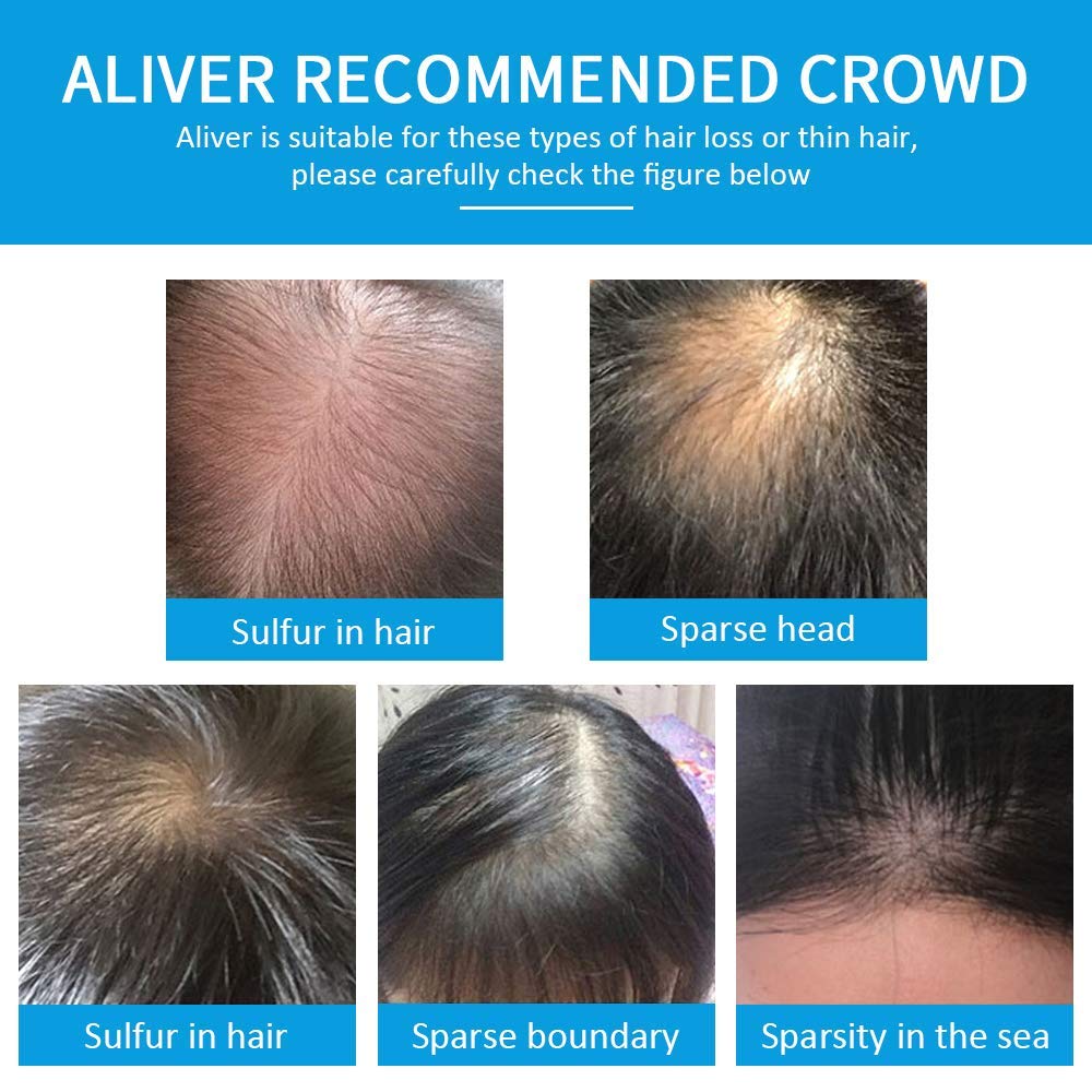 Aliver Hair Fibers for Thinning Hair Dark Brown - Undetectable Natural Formula - Thicker Fuller Hair in 15 Seconds - Conceals Hair Loss & Look Younger - Designed for Men & Women,0.97Oz