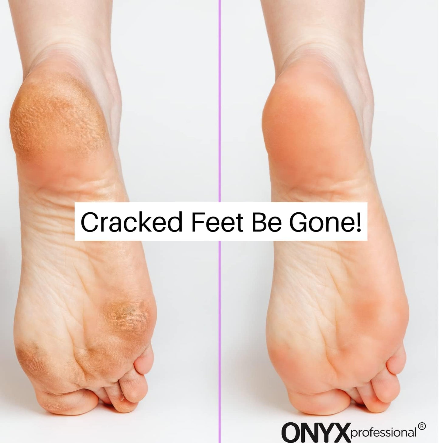 Onyx Professional Gel Moisturizing Socks, One Size Dry Feet Treatment for Women or Men, Hydrating Spa Socks for Dry Feet and Cracked Heel Repair, One Reusable Pair