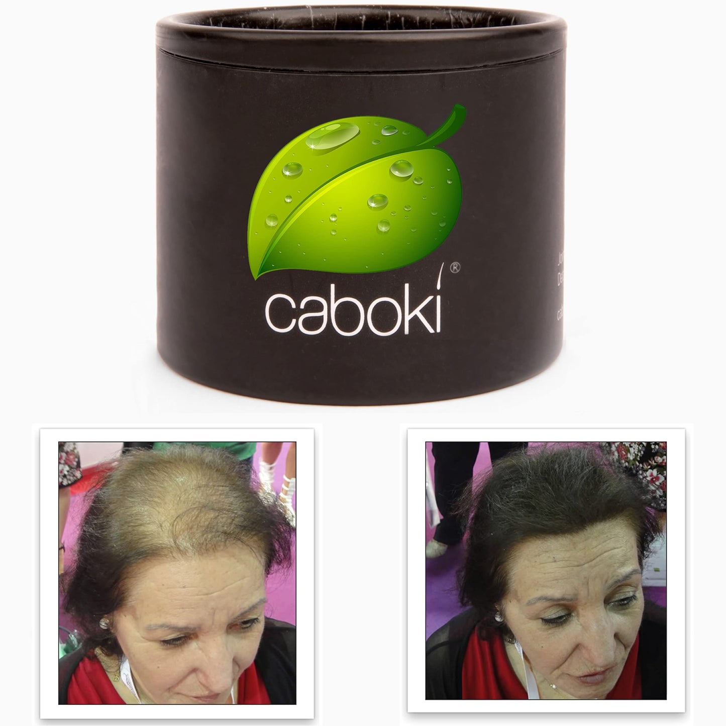 Hair Thickening Fibers. Cover Bald Spot and Thinning Hair Instantly. Make Thin Hair Look 10X Fuller. All-Natural Hair Building Fiber. Trial Size (10-Day Supply). Silver/White