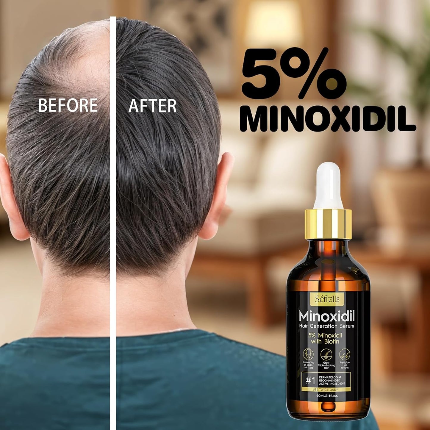 5% Minoxidil Hair Growth Serum Oil For Men and Women, Biotin Hair Serum, Safest Hair Regrowth Treatment, Prevent Scalp Hair Loss 60ml / 2.11 fl.oz