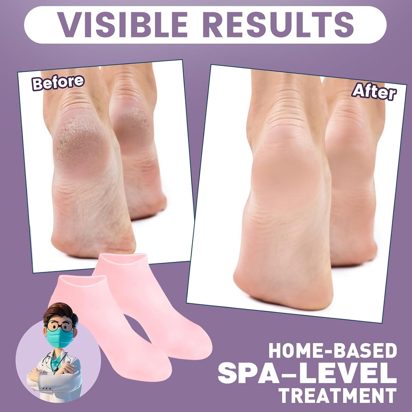 5 Pairs Silicone Socks for Dry Cracked Feet, Women's Moisturizing Foot Socks (Pink, Fits Up to Size 9)