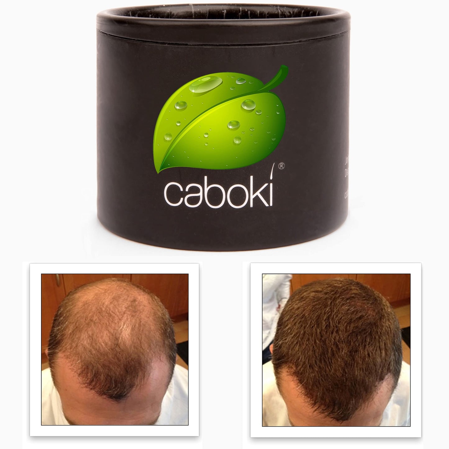 Hair Thickening Fibers. Cover Bald Spot and Thinning Hair Instantly. Make Thin Hair Look 10X Fuller. All-Natural Hair Building Fiber. Trial Size (10-Day Supply). Silver/White