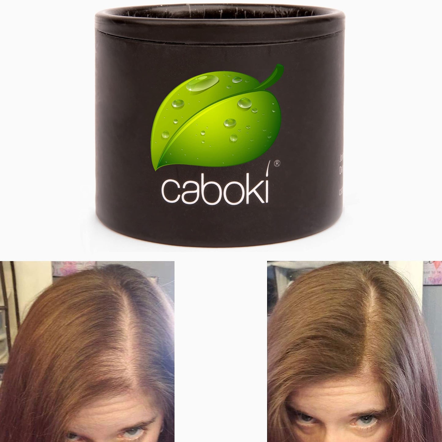 Hair Thickening Fibers. Cover Bald Spot and Thinning Hair Instantly. Make Thin Hair Look 10X Fuller. All-Natural Hair Building Fiber. Trial Size (10-Day Supply). Silver/White