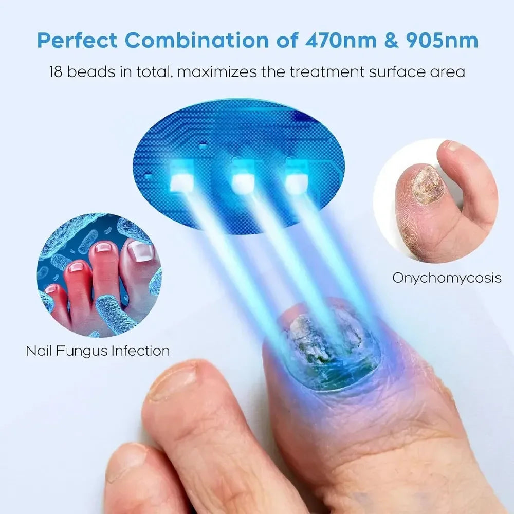 Fungal Nail Laser Device Toe Nail Fungus Removal Fast Repair Onychomycosis Toenail Fingernail Foot Care Cure Ingrown