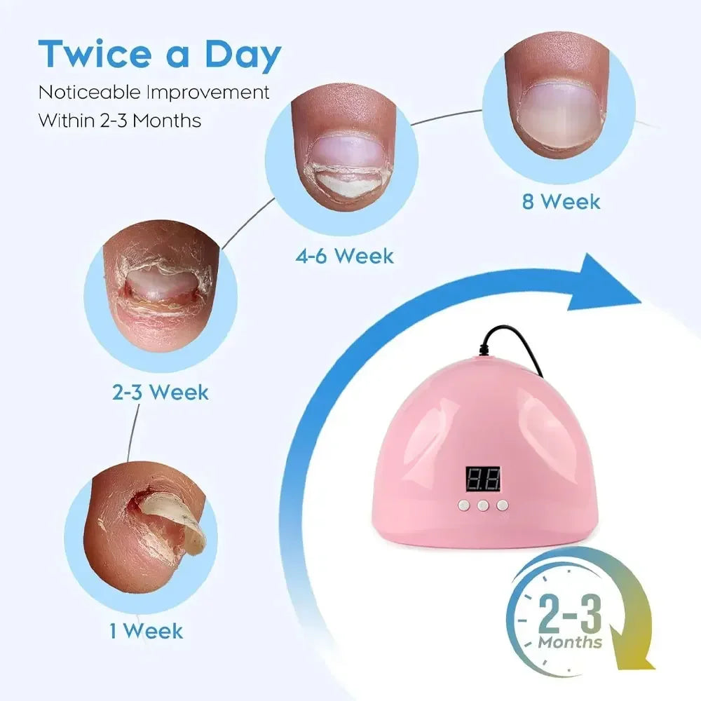 Fungal Nail Laser Device Toe Nail Fungus Removal Fast Repair Onychomycosis Toenail Fingernail Foot Care Cure Ingrown