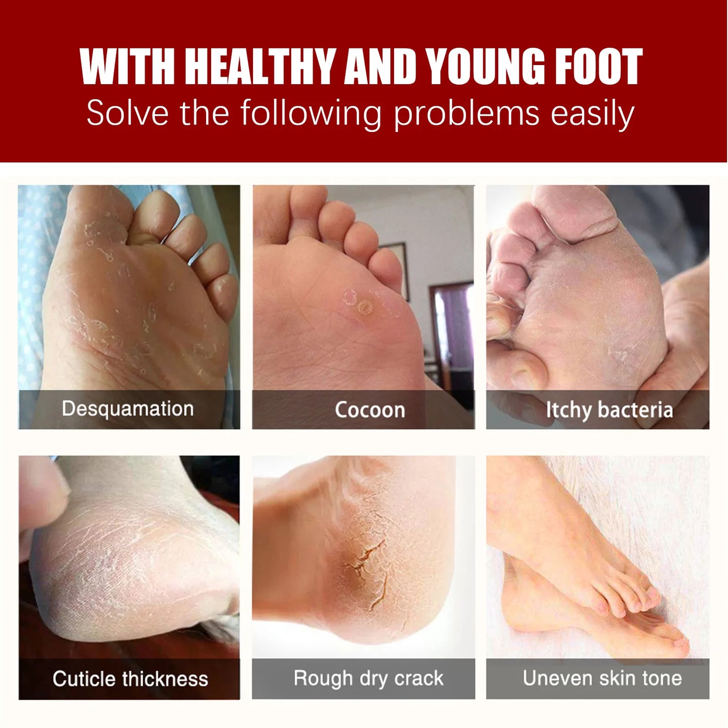 5/1Pair Feet Exfoliating Foot Masks Pedicure Socks Exfoliation Scrub for Feet Mask Pedicure Stone Foot Peeling Mask For Foot Spa