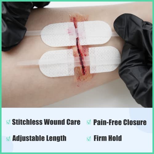 RHINO RESCUE Wound Closure Kit, 6pcs with Dresssings, Wound Closure Strips Without Suture, Stitch Zip Laceration Closure Kit for Cut Care, Adhesive Wound Closure Bandages, HSA/FSA Eligible