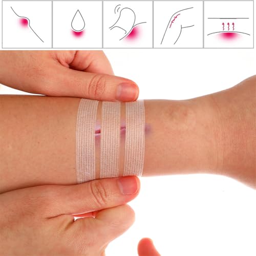 Skin Wound Closure Tape 24pcs Wound Suture Closure Strips Emergency Wound Closure Device Laceration Closure Kit Repair Wounds Without Stitches 12x100mm