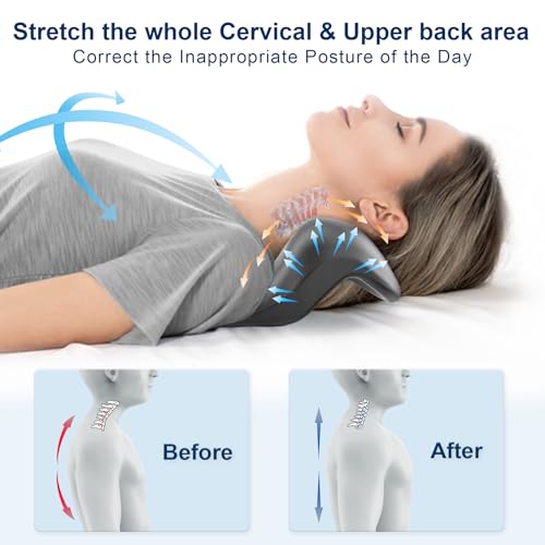 Neck and Shoulder Relaxer with Upper Back Massage Point, Cervical Traction Device Neck Stretcher for TMJ Pain Relief and Cervical Spine Alignment Chiropractic Pillow (Grey)