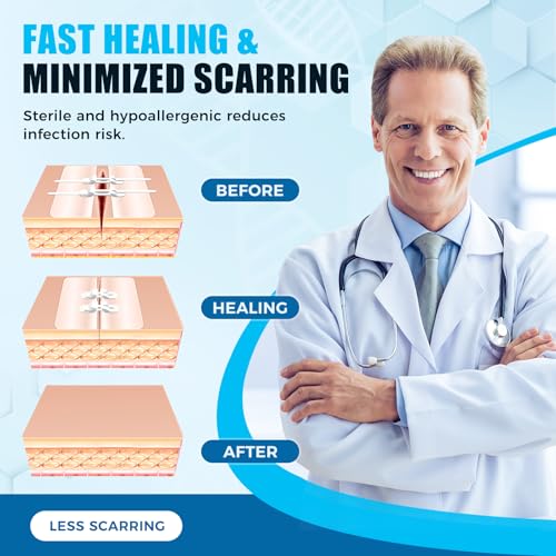 Sutures Butterfly Bandaids - 4 Pcs Laceration Closure Kit - Surgical Laceration Repair Without Sew - Quick Clot -Emergency Wound Closures Device (PU)