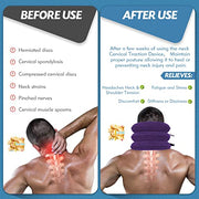 Neck Stretcher, Cervical Traction Device, Neck Traction Device, Neck Pain Relief, Adjustable Inflatable Neck Brace & Neck Stretcher Cervical Traction, Neck Decompression Home Use (Purple)