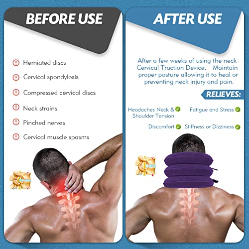 Neck Stretcher, Cervical Traction Device, Neck Traction Device, Neck Pain Relief, Adjustable Inflatable Neck Brace & Neck Stretcher Cervical Traction, Neck Decompression Home Use (Purple)