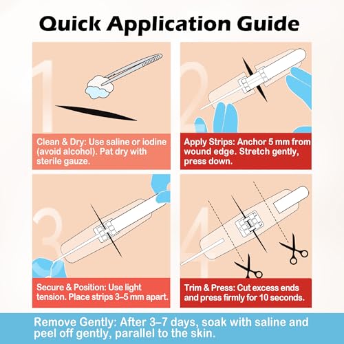 Wound Closure Strips(0.6"x 3.1" - 4 Pcs), Butterfly Bandages for Wound Care, Steri Emergency Laceration Closures Without Stitches for Outdoors Use.