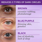 TATCHA The Brightening Eye Cream | Brightening & Dark Circle Reduction with Vitamin C for Bight, Firm Undereyes, 15 ml / 0.5 fl. oz.