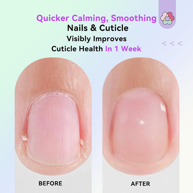 SAVILAND Soothing Cuticle Oil Pen: 6Pcs Plant-Based Nail Oil with Aloes Vitamin E Nail Strengthener Refreshing Nail Growth Serum Cuticle Softener for Moisturizing Repairing Dryness Redness Peeling