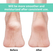 Vaincre Gel Moisturizing Heel Socks for Dry Cracked Feet Women, 4 Pairs Foot Care Spa Moisture Toeless Socks for Cracked Heel Repair Treatment Overnight (Regular)