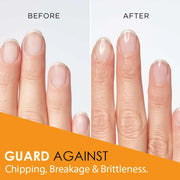 Natural Nail Growth Oil. Powerful Blend of Rosehip, Jojoba & Amond Oils. Promotes Stronger, Healthier Nails. Hydrates & Strengthens Cuticles for Faster Nail Growth - 1 Fl Oz