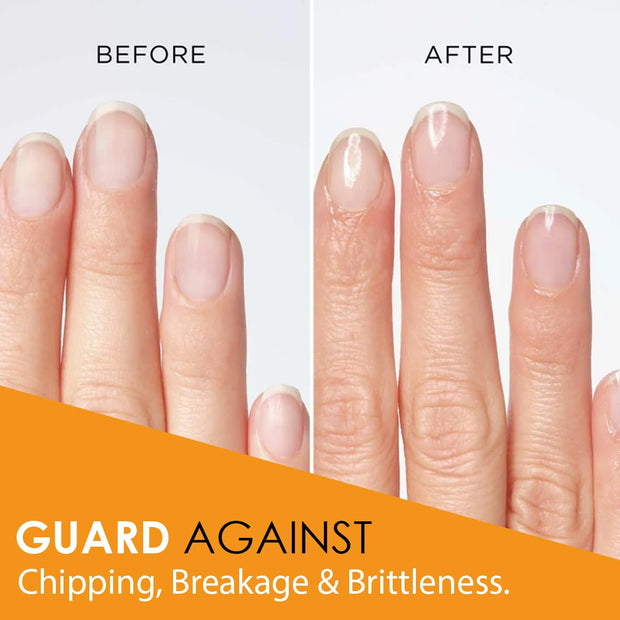 Natural Nail Growth Oil. Powerful Blend of Rosehip, Jojoba & Amond Oils. Promotes Stronger, Healthier Nails. Hydrates & Strengthens Cuticles for Faster Nail Growth - 1 Fl Oz