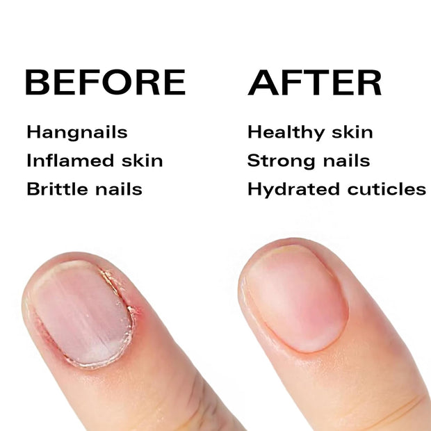 Nail Oil Cuticle Pen - Fragrance Free - Nail Strengthener & Growth Serum with Vitamin A, D, E, B5, Grapeseed & Natural Oils - Repair for Brittle, Peeling, Thin Nails (No Scent)