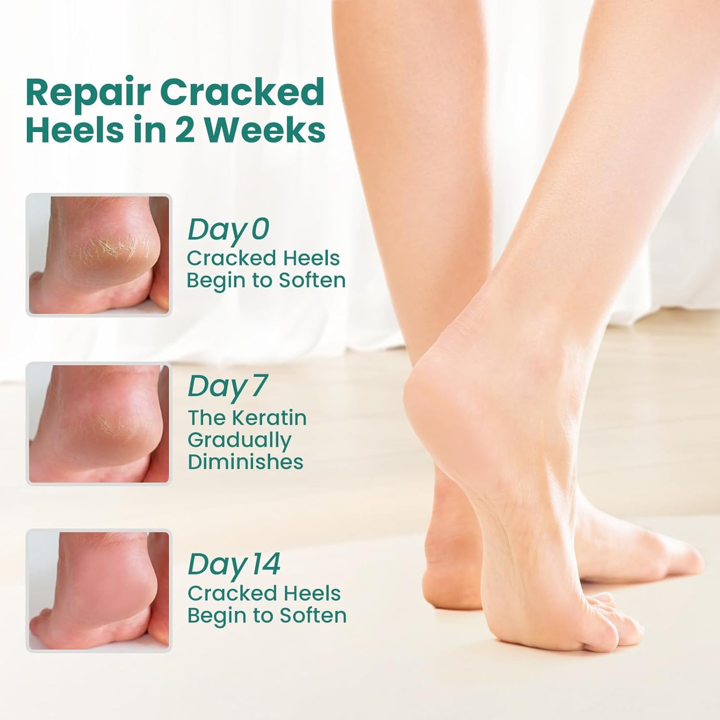 Welnove Moisturizing Heel Socks - 2 Pairs Aloe Vera Extract Infused Gel Lining for Dry Feet - Cracked Heel Repair Treatment - Cotton Socks for Women Men Foot Care (Regular Sizes)