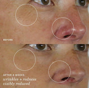 Tatcha The Silk Serum Wrinkle-Smoothing Retinol Alternative | 30 ml / 1 oz