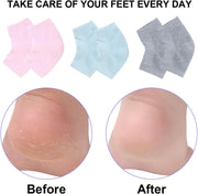 Vented Moisturizing Gel Heel Socks, 3 Pairs Toeless Spa Sock for Foot Care Treatment, Cracked Heels, Dry Feet, Foot Calluses (Gray, Green, Pink)