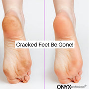 Onyx Professional Gel Moisturizing Socks, One Size Dry Feet Treatment for Women or Men, Hydrating Spa Socks for Dry Feet and Cracked Heel Repair, One Reusable Pair