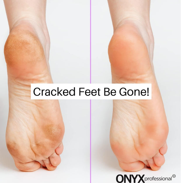 Onyx Professional Gel Moisturizing Socks, One Size Dry Feet Treatment for Women or Men, Hydrating Spa Socks for Dry Feet and Cracked Heel Repair, One Reusable Pair