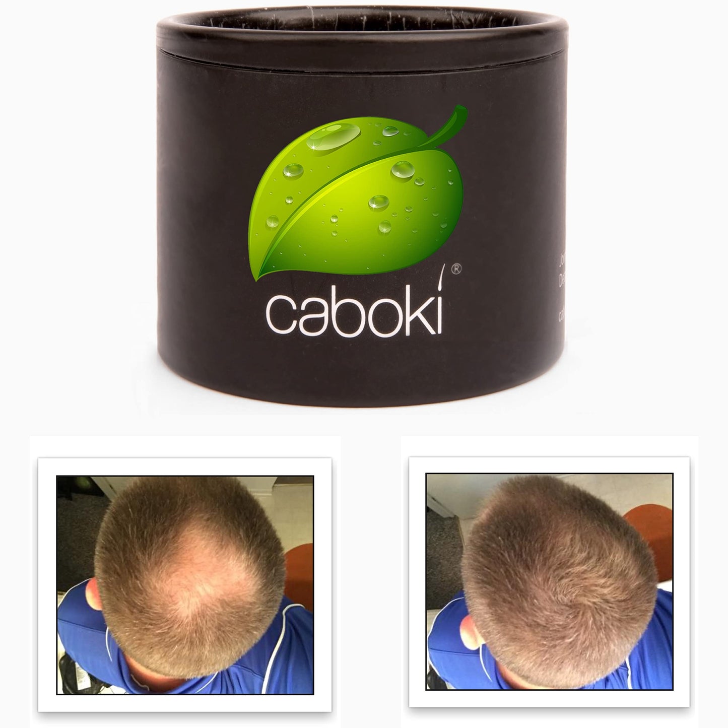 Hair Thickening Fibers. Cover Bald Spot and Thinning Hair Instantly. Make Thin Hair Look 10X Fuller. All-Natural Hair Building Fiber. Trial Size (10-Day Supply). Silver/White