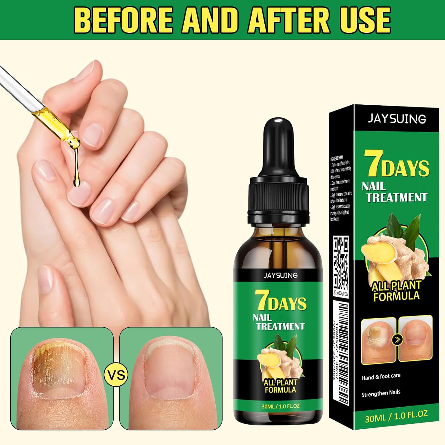 Ginger Nail Growth Serum, 7 Days Nail Treatment, Ginger Nail Treatment, Ginger Cuticle Care Oil for Strengthen & Promote Nail Growth (2Pcs)