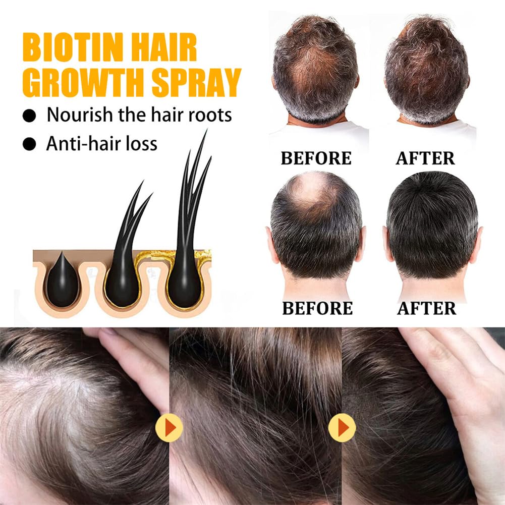 Moonbiffy Biotin Premium Hair Growth Serum for Thicker, Longer & Stronger Hair (2PCS)