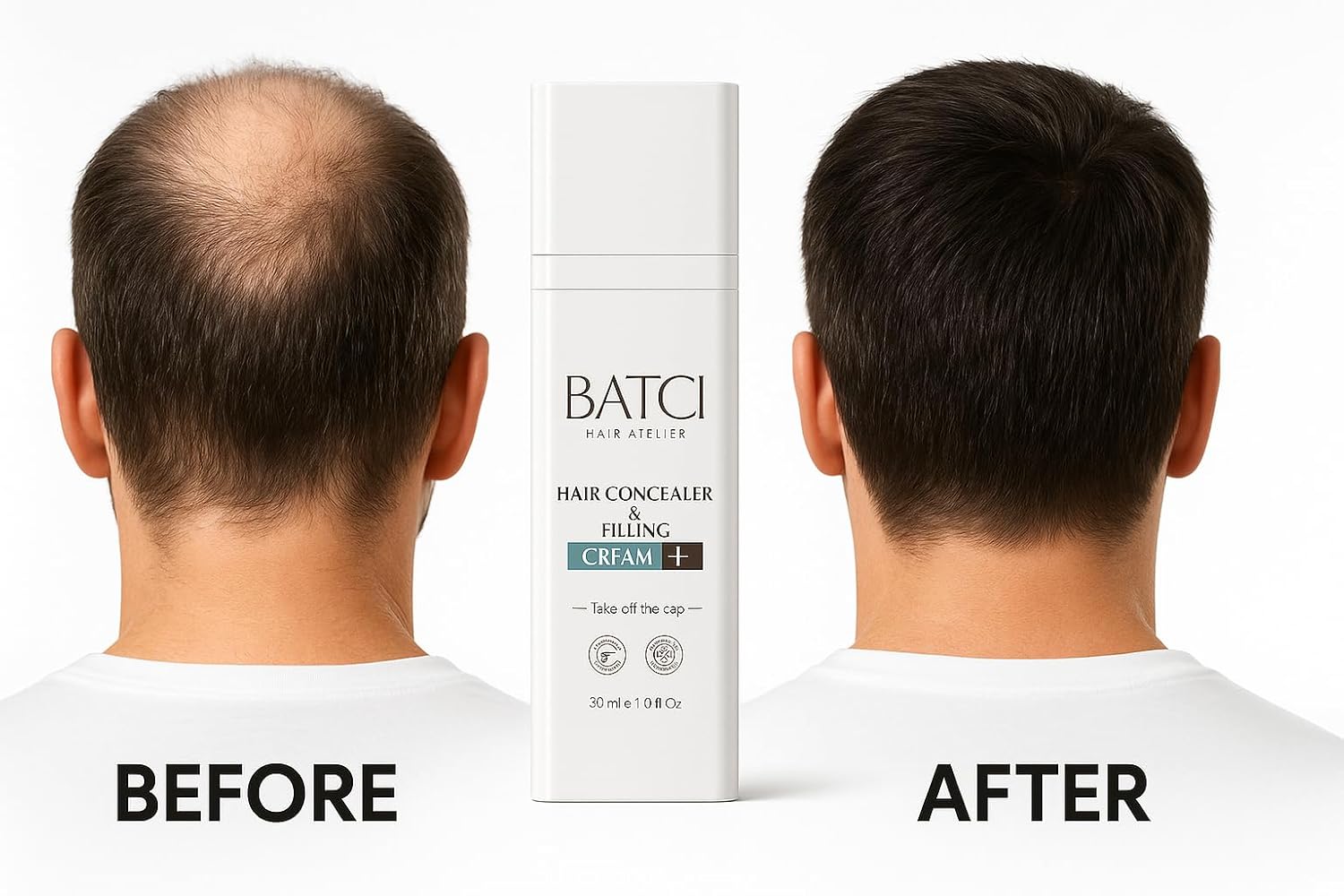 Batcı Hair Concealer & Filling Cream for Bald Spots & Thinning Hair – Waterproof, Sweat-Proof Scalp Coverage – Natural Root Touch-Up Cream for Men & Women – 30ml