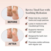 Kitsch Moisturizing Socks for Cracked Heel Treatment – Reusable Spa Socks for Women & Men with Insulated Gel Lining - Overnight Heel Socks for Dry Cracked Feet, Hydrating, Open-Toe Design - 1 Pair