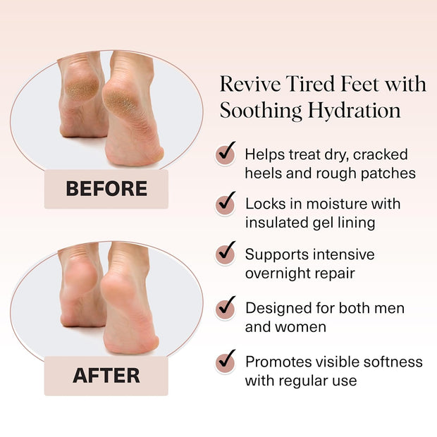 Kitsch Moisturizing Socks for Cracked Heel Treatment – Reusable Spa Socks for Women & Men with Insulated Gel Lining - Overnight Heel Socks for Dry Cracked Feet, Hydrating, Open-Toe Design - 1 Pair