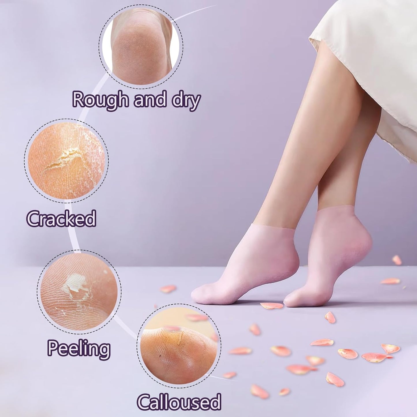 5 Pairs Silicone Socks for Dry Cracked Feet, Women's Moisturizing Foot Socks (Pink, Fits Up to Size 9)