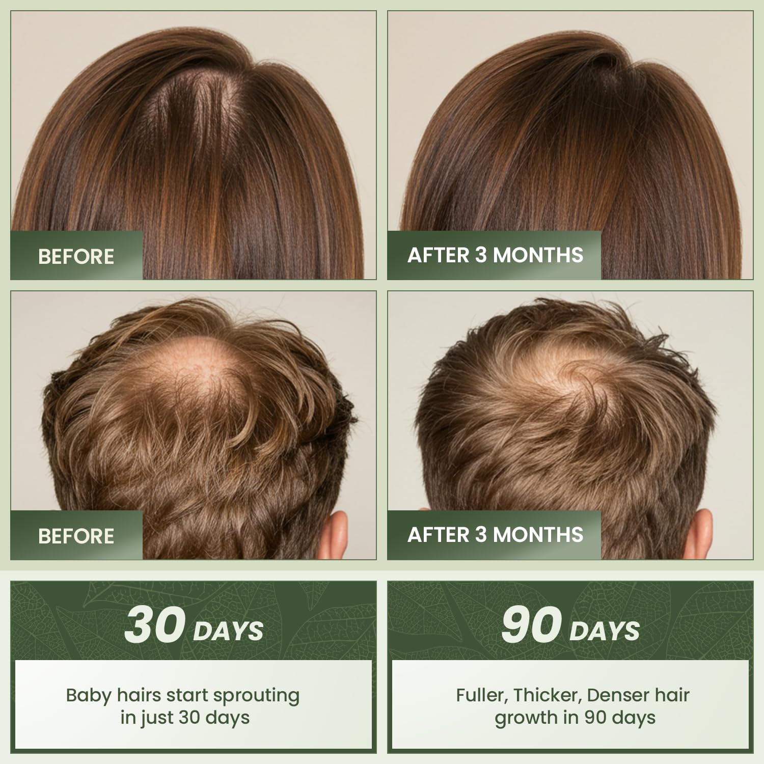 Essynaturals Hair Growth Oil with Biotin - Caffeine and Castor Oil for Fuller, Thicker, Longer Hair