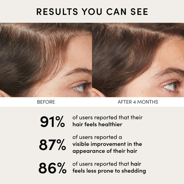 OUAI Scalp Serum - Balancing Hair Serum with Red Clover Extract, Siberian Ginseng and Peptides for Thicker and Fuller-Looking Hair - Paraben, Phthalate and Sulfate Free Scalp Care (2 Fl Oz)