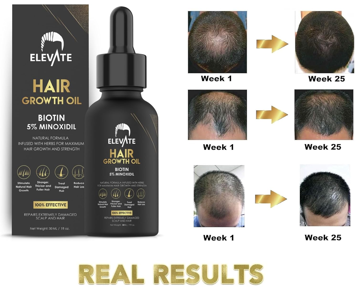 ELEVATE Hair Growth Oil - Biotin Serum & 5% Minoxidil Treatment for Stronger Thicker Longer Hair – Natural Hair Growth Thickening Treatment - Stop Thinning & Hair Loss for Men & Women 1oz