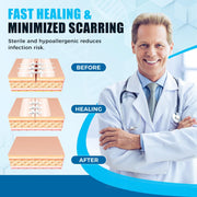 Sutures Butterfly Bandaids - 4 Pcs Laceration Closure Kit - Surgical Laceration Repair Without Sew - Quick Clot -Emergency Wound Closures Device (PU)