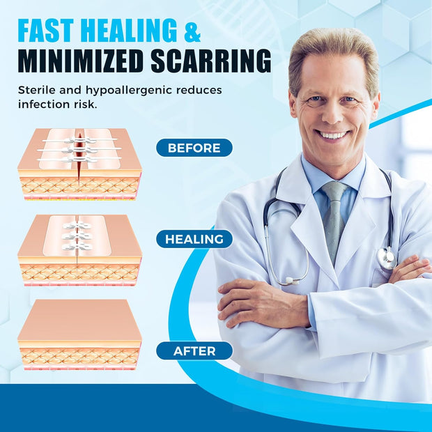 Sutures Butterfly Bandaids - 4 Pcs Laceration Closure Kit - Surgical Laceration Repair Without Sew - Quick Clot -Emergency Wound Closures Device (PU)