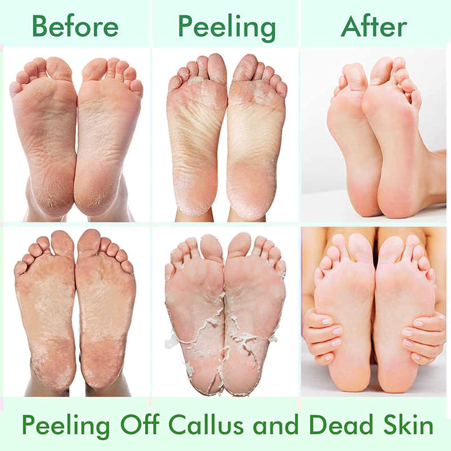 5 Pack Foot Peeling Mask,Exfoliator Peel Off Calluses Dead Skin Callus Remover,Foot Mask for Dry Cracked Feet,Foot Peel Masks for Men and Women Feet Peeling Mask for Fathers Day Gift for Husband