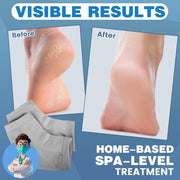 Moisturizing Heel Socks - 6 Pairs for Dry Cracked Feet, Toeless Gel Socks for Hydration and Repair