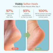 ZenToes Moisturizing Socks for Cracked Heel Treatment - Vitamin E, Olive Oil and Jojoba Oil Infused Heel Socks to Soften and Hydrate (Fuzzy Blue, Regular)