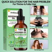3 Pack Rosemary Oil for Hair Growth,Rosemary Hair Growth Oil,Hair Strengthening Serum for Dry Damaged Hair,Hair Loss Treatment & Thickens Hair,Scalp Care Promotes Hair Thickness for Men Women