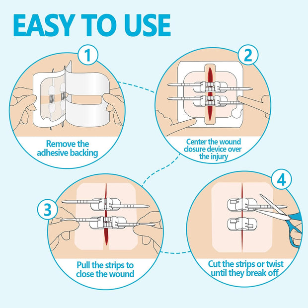 Sutures Butterfly Bandaids - 4 Pcs Laceration Closure Kit - Surgical Laceration Repair Without Sew - Quick Clot -Emergency Wound Closures Device (PU)