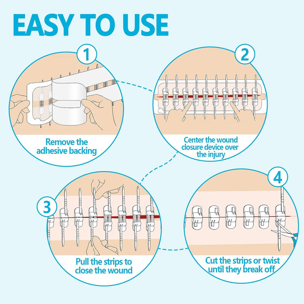 Sutures Butterfly Bandaids - 4 Pcs Laceration Closure Kit - Surgical Laceration Repair Without Sew - Quick Clot -Emergency Wound Closures Device (PU)