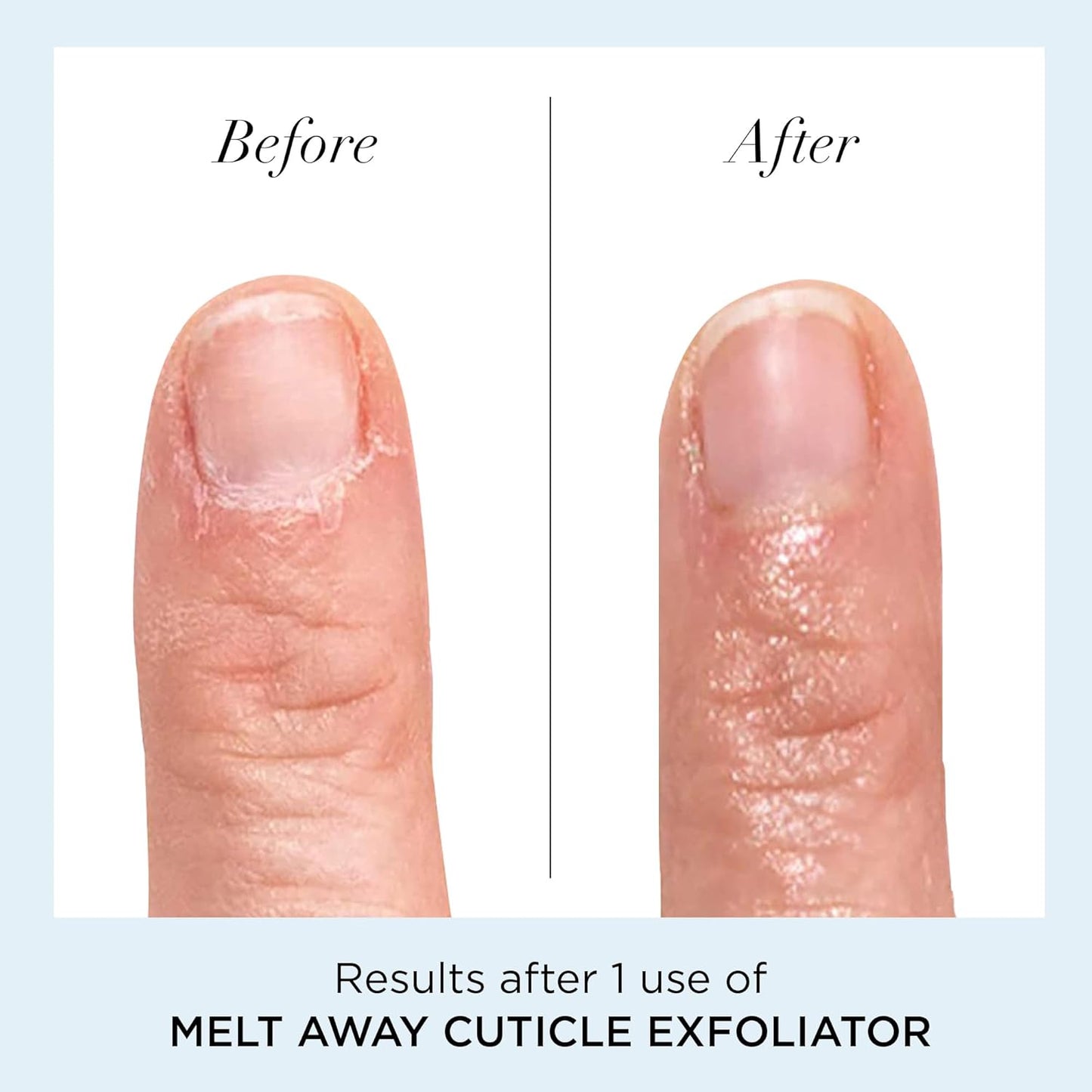 butter LONDON Cuticle Remover Liquid, Melt Away - Cuticle Softener Oil Exfoliator Gently Removes Dry & Overgrown Skin - Nail Care for Clean & Healthy-Looking Nails, Home Manicure & Pedicure