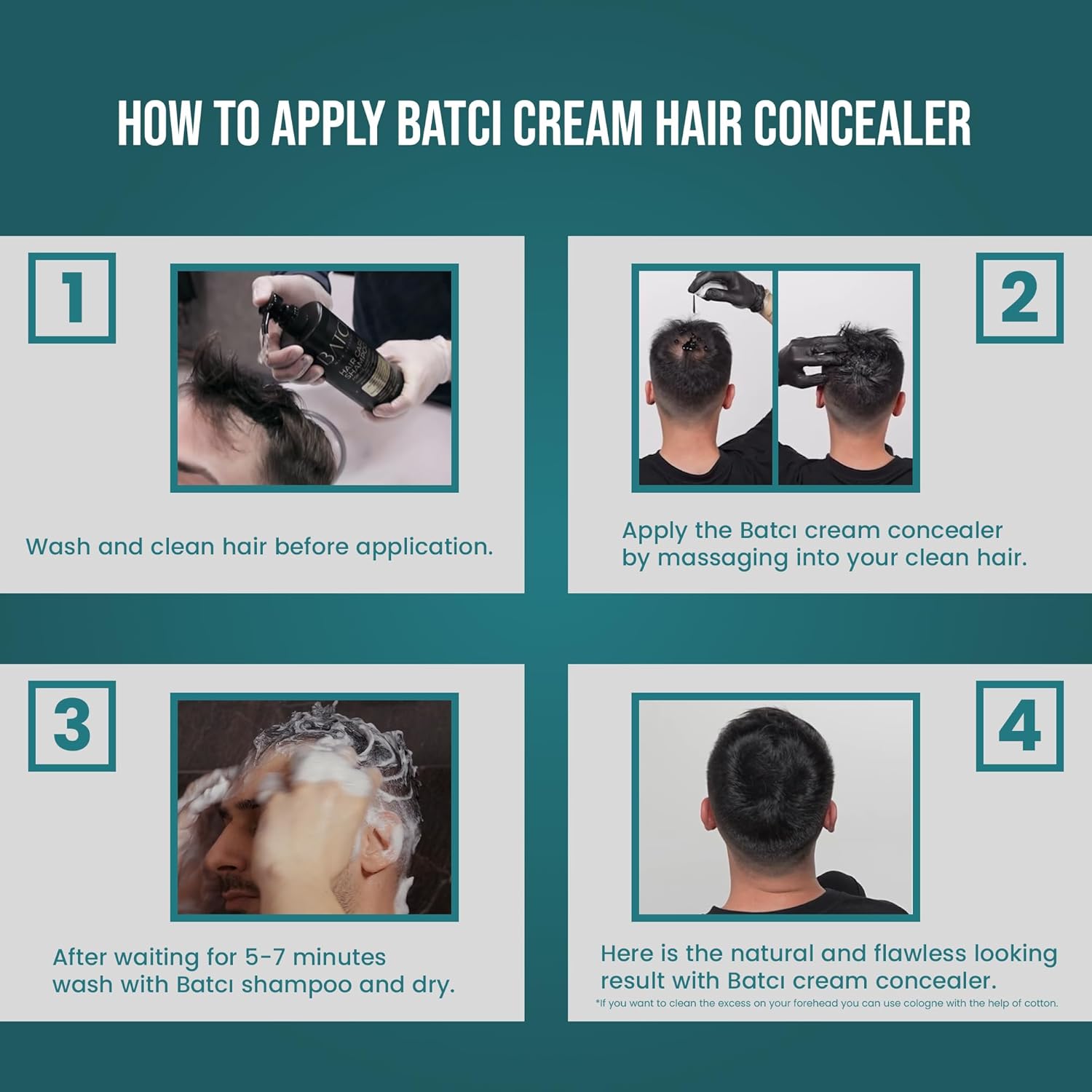 Batcı Hair Concealer & Filling Cream for Bald Spots & Thinning Hair – Waterproof, Sweat-Proof Scalp Coverage – Natural Root Touch-Up Cream for Men & Women – 30ml