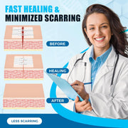 Sutures Butterfly Bandaids - 4 Pcs Laceration Closure Kit - Surgical Laceration Repair Without Sew - Quick Clot -Emergency Wound Closures Device (PU)